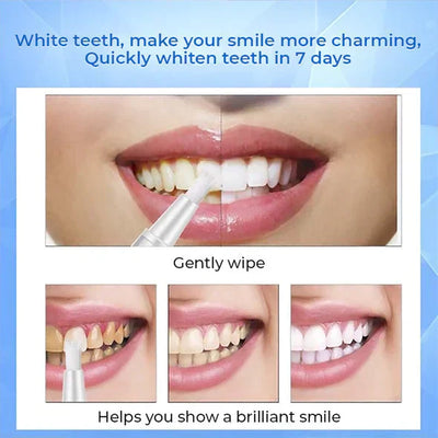 Teeth Whitening Pen